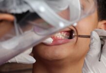 Governo federal incorpora programa de saúde bucal ao SUS