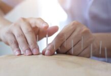 Brasil regulamenta exercício profissional da acupuntura