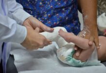 Hospital Pedro I implanta serviço de ortopedia pediátrica com foco em pé torto e doenças congênitas
