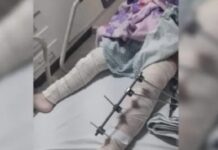 Erro médico no Trauma de Campina Grande entra na mira do Ministério Público