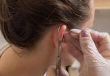 Auriculoacunputura: como funciona esse método terapêutico?