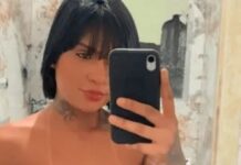 Mulher que teve pernas amputadas após ser atropelada e arrastada passará por nova cirurgia